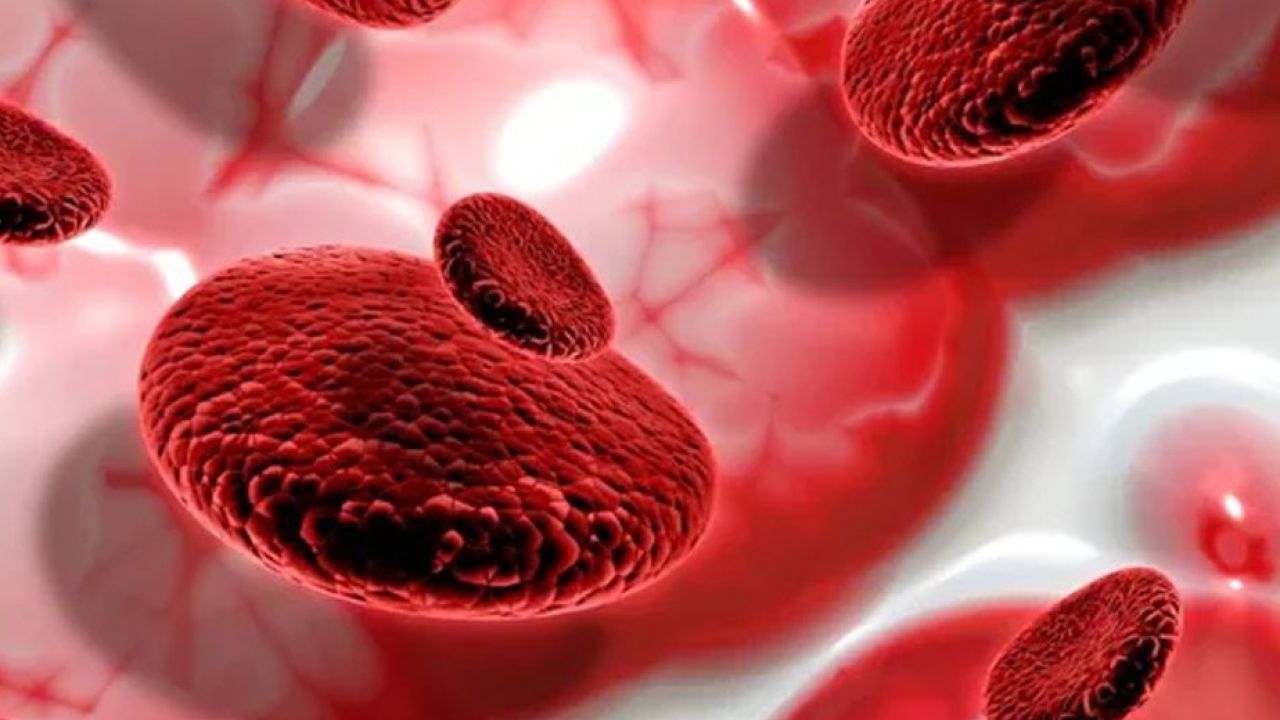 অ্যাপ্লাস্টিক অ্যানিমিয়া: হাড়ের মজ্জার এক বিরল ও ঝুঁকিপূর্ণ রোগ, লক্ষণ ও প্রতিকার