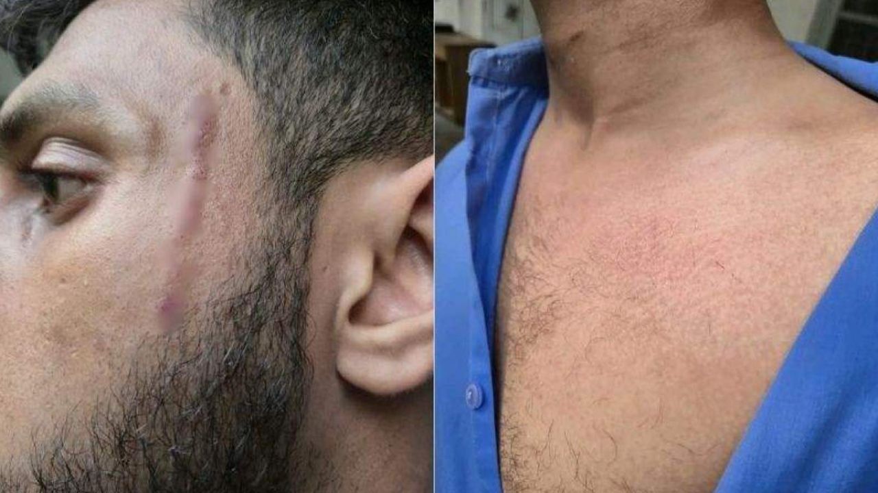 কুমিল্লা পলিটেকনিকে সাংবাদিকের ওপর ছাত্রদলের হামলার অভিযোগ