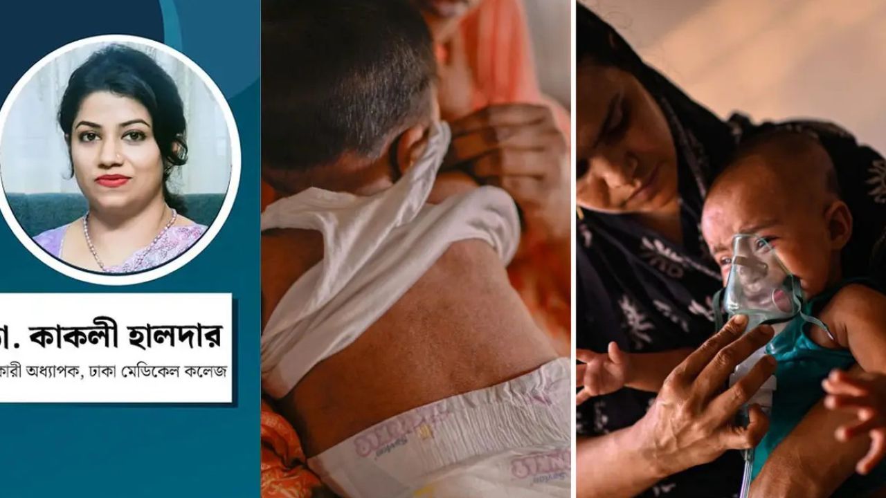 হামের প্রকোপে বাংলাদেশ উচ্চ ঝুঁকিতে: করণীয় ও সতর্কতা