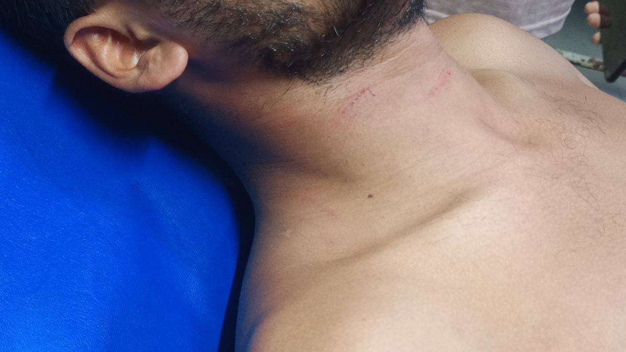 কিশোরগঞ্জে সাংবাদিকের ওপর সন্ত্রাসী হামলার তীব্র নিন্দা