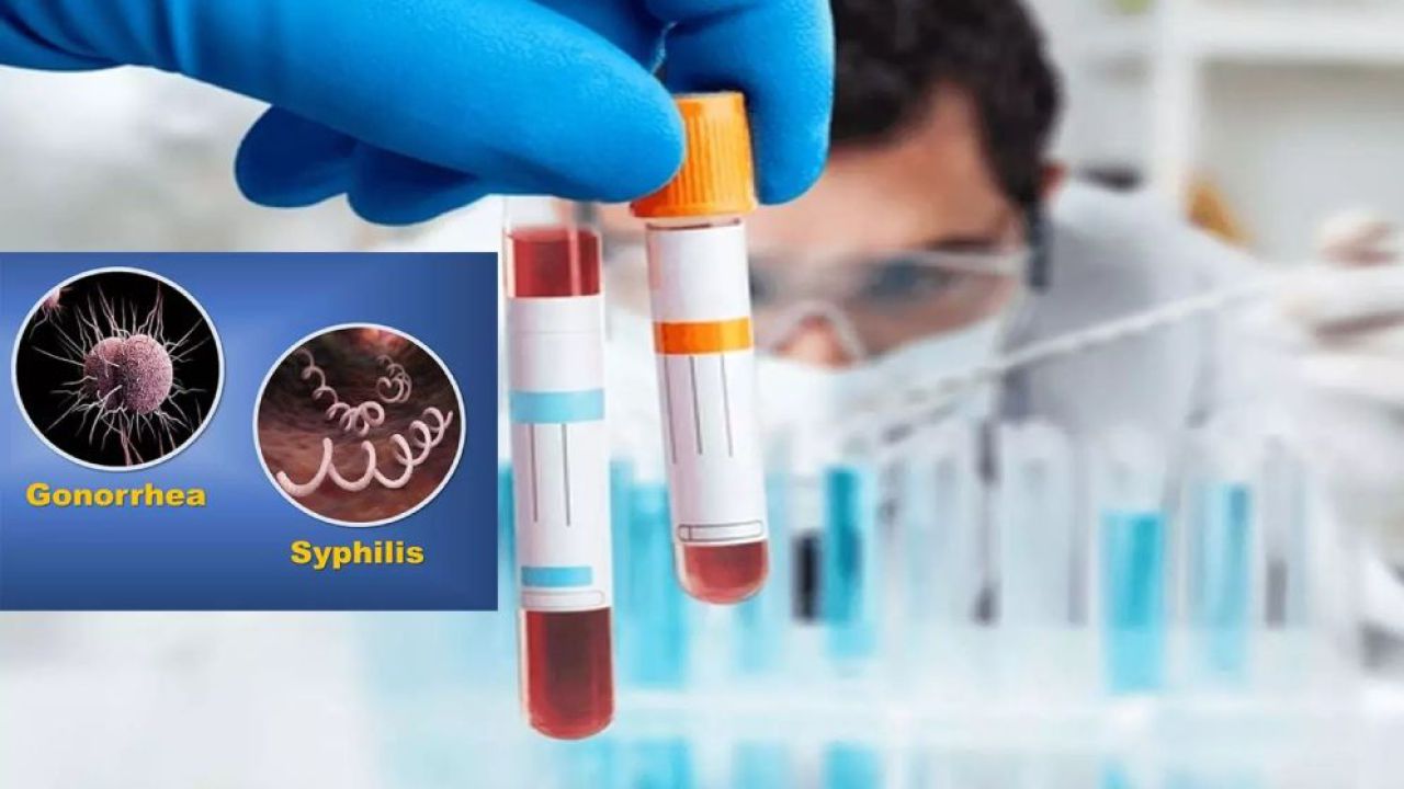 ইউরোপে রেকর্ড হারে বাড়ছে সিফিলিস-গনোরিয়া