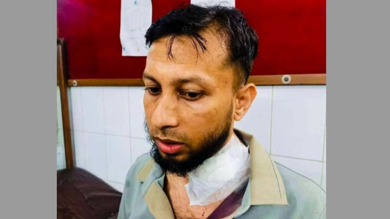 কুমিল্লার মুরাদনগরের এসিল্যান্ডের ওপর ডাকাত দলের নৃশংস হামলা, হাসপাতালে চিকিৎসাধীন